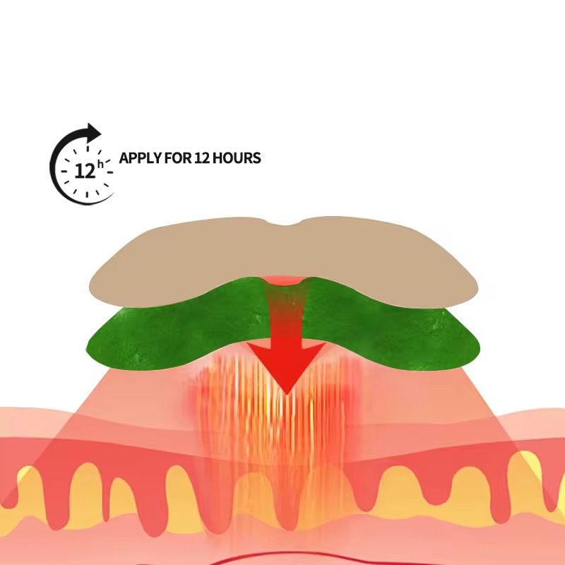 Plasturi Naturali cu Pelin și Ghimbir – Pentru Toate Zonele Corpului 100 BUCATI