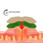 Plasturi Naturali cu Pelin și Ghimbir – Pentru Toate Zonele Corpului 100 BUCATI